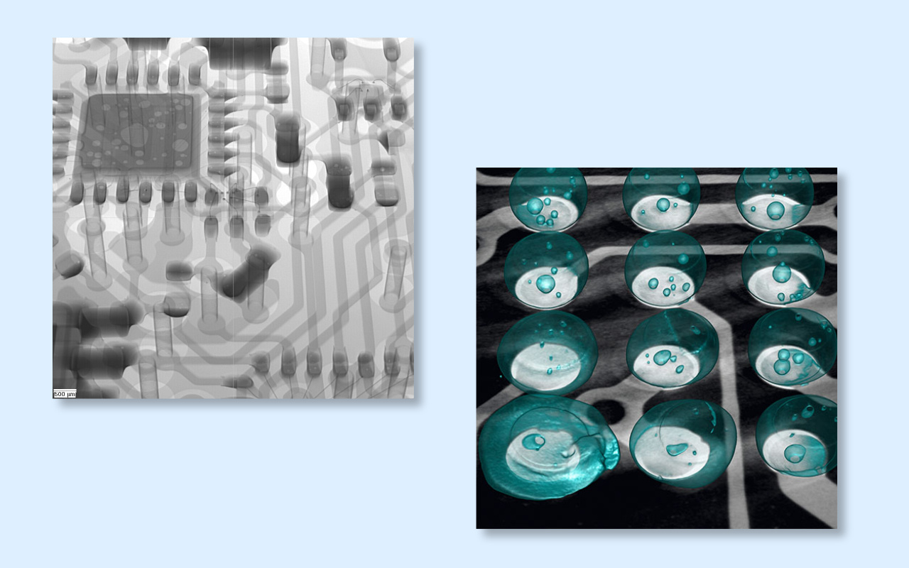 4. 2D vs 3D CT X-ray De care aveți cu adevărat nevoie?